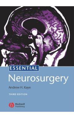 Essential Neurosurgery 3E