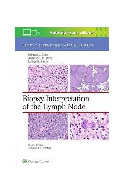 Biopsy Interpretation of the Lymph Node