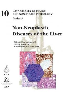 Non-Neoplastic Diseases of the Liver (Series 5)