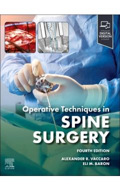 Operative Techniques: Spine Surgery