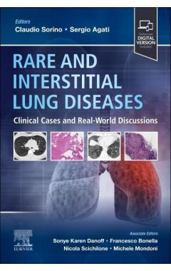 Rare and Interstitial Lung Diseases: Clinical Cases and Real-World Discussions