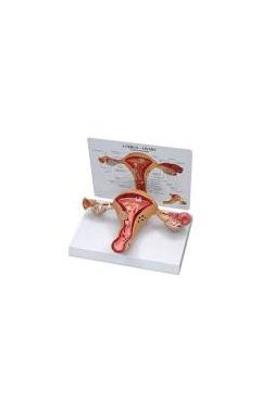 Uterus-Ovary Model