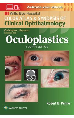 Oculoplastics