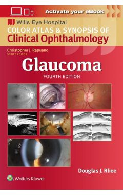 Glaucoma
