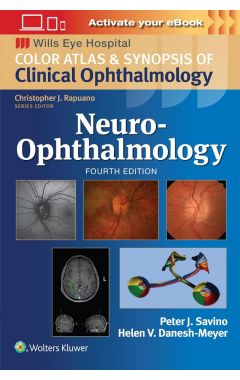 Neuro-Ophthalmology: Print + eBook with Multimedia