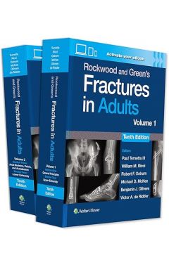 Rockwood and Green's Fractures in Adults 10e: Print + eBook with Multimedia