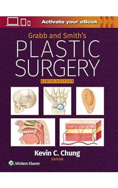 Grabb and Smith's Plastic Surgery: Print + eBook with Multimedia