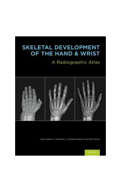 [POD]  SKELETAL DEVELOPMENT OF THE HAND AND WRIST