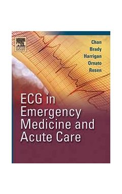 ECG in Emergency Medicine and Acute Care