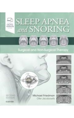 Sleep Apnea and Snoring: Surgical and Non-Surgical Therapy 2e