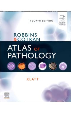 Robbins and Cotran Atlas of Pathology