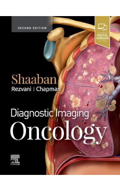 Diagnostic Imaging: Oncology
