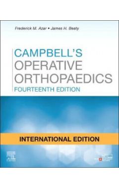 Campbell's Operative Orthopaedics, 4-Volume Set - International Edition
