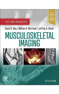 Musculoskeletal Imaging: The Core Requisites