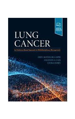 Lung Cancer: An Evidence-Based Approach to Multidisciplinary Management