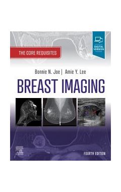 Breast Imaging: The Core Requisites