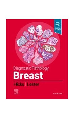 Diagnostic Pathology: Breast