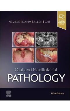 Oral and Maxillofacial Pathology 5e