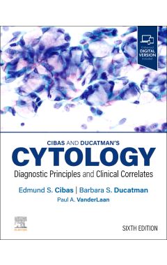 Cibas and Ducatman’s Cytology 6e