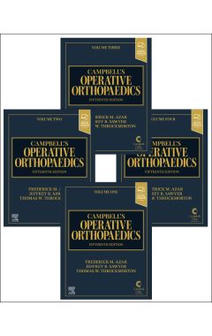 Campbell's Operative Orthopaedics, 4-Volume Set