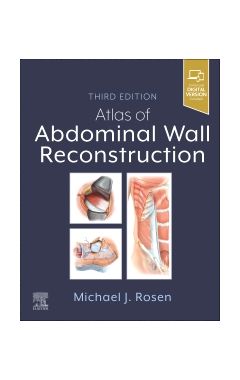 Atlas of Abdominal Wall Reconstruction