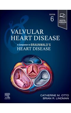 Valvular Heart Disease: A Companion to Braunwald's Heart Disease