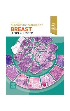 Diagnostic Pathology: Breast, 4th Edition