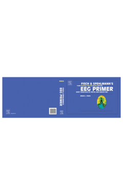 (POD) Fisch and Spehlmann's EEG Primer: Basic Principles of Digital and Analog EEG
