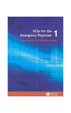 ECG's for the Emergency Physician 1