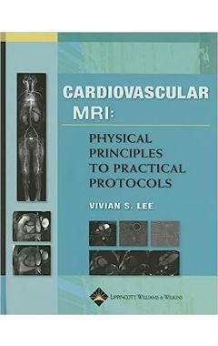 CARDIOVASCULAR MRI IMAGING PHYSICAL PRINCIPLES TO PRACTICAL PROTOCOLS