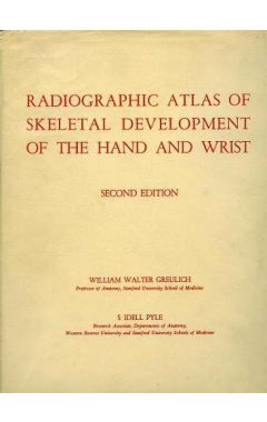 Radiographic Atlas of Skeletal Development of the Hand and Wrist 2