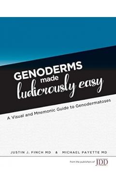 Genoderms Made Ludicrously Easy