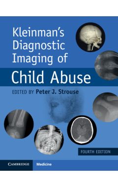 Kleinman's Diagnostic Imaging of Child Abuse 4e