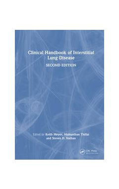Clinical Handbook of Interstitial Lung Disease