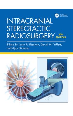 Intracranial Stereotactic Radiosurgery