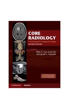 Core Radiology: A Visual Approach to Diagnostic Imaging