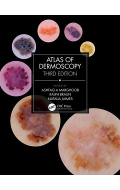 Atlas of Dermoscopy: Third Edition