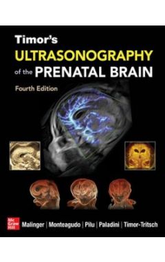 Timor's Ultrasonography of the Prenatal Brain, Fourth Edition