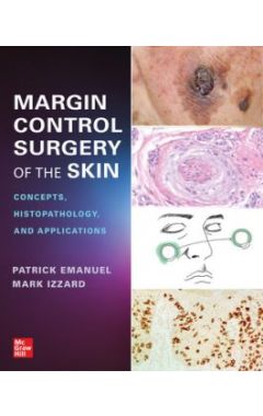 MARGIN CONTROL SURGERY OF THE SKIN