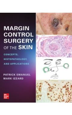 Margin Control Surgery of the Skin: Concepts, Histopathology, and Applications