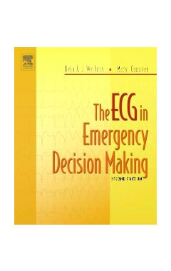 The ECG in Emergency Decision Making 2