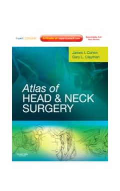 Atlas of Head and Neck Surgery: Expert Consult - Online and Print