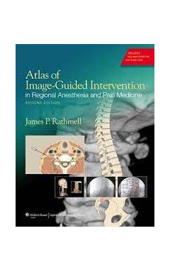 Atlas Of Image-Guided Intervention In Regional Anesthesia And Pain Medicine 2E