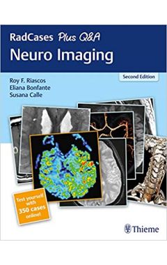 RadCases Plus Q&A Neuro Imaging