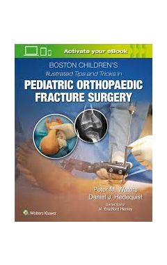 Boston Children's Illustrated Tips and Tricks  in Pediatric Orthopaedic Fracture Surgery