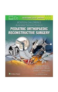 Boston Children's Illustrated Tips and Tricks in Pediatric Orthopaedic Reconstructive Surgery