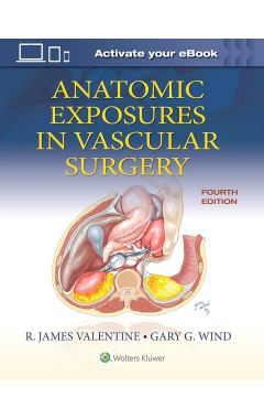 Anatomic Exposures in Vascular Surgery 4e