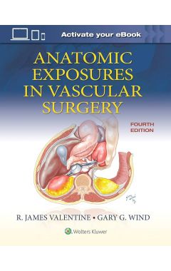 Anatomic Exposures in Vascular Surgery