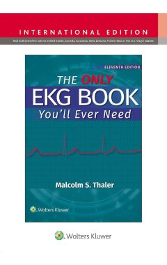 The Only EKG Book You'll Ever Need