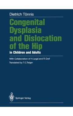 Congenital Dysplasia and Dislocation of the Hip in Children and Adults Softcover reprint of the